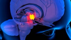 A 43-Year-Old Woman With Excessive Sweating and Feeling Hot