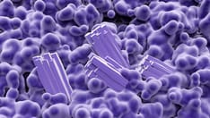 Immunoglobulin A Nephropathy (IgAN): 5 Differential Diagnoses to Know