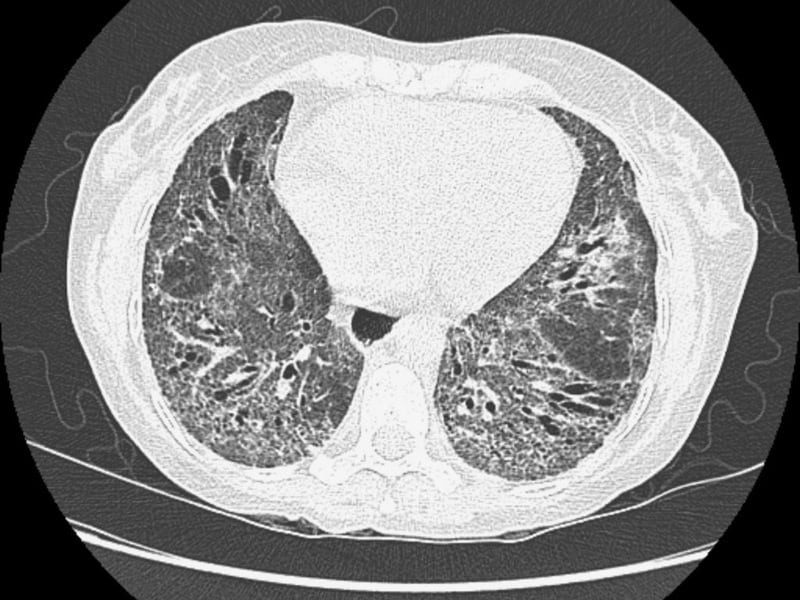 CHEST 2015: American College of Chest Physicians Meeting