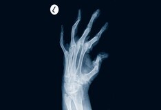 09gnvuaictjofm Places phoenix, arizona medical and healthdoctorinternist (internal medicine) estrella internal medicine and geriatrics clinic, plc posts. https reference medscape com drug stelara ustekinumab 345050