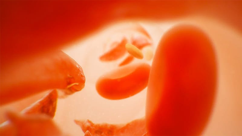 Born Into Pain: Pushing for Progress in Sickle Cell Disease