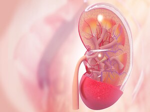 Renal Denervation Shown Safe and Effective in Pivotal Trial