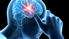 Role of Oral CGRP Antagonists in the Preventive Management of Migraine