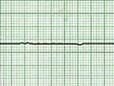 ACLS and BLS Recommendations You Must Know