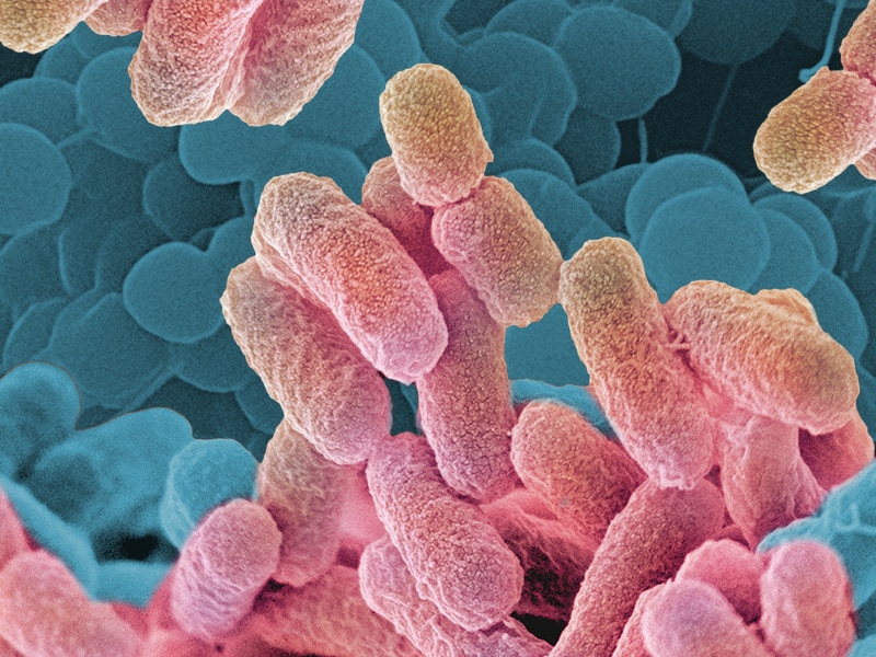 Special Report: Antimicrobial Resistance -- Time For Change