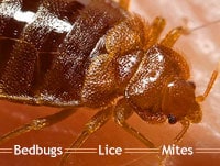 When Bugs Feast: What's Causing That Itch?