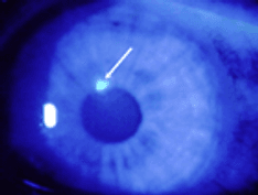 ss-common-eye-conditions