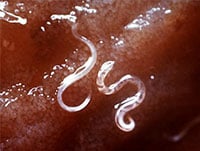 12 Common Intestinal Parasites