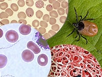 Lyme Disease and 4 Emerging Tick-Borne Illnesses