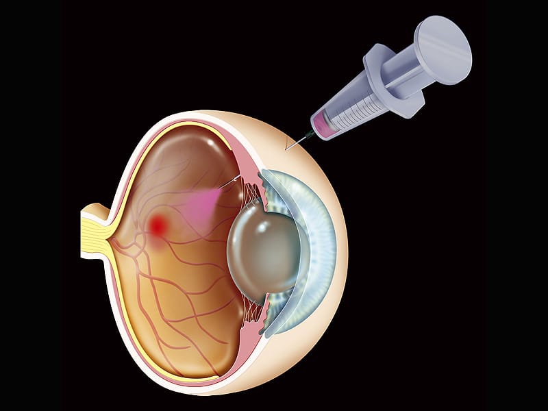 European Society of Retina Specialists 16th EURETINA Congress