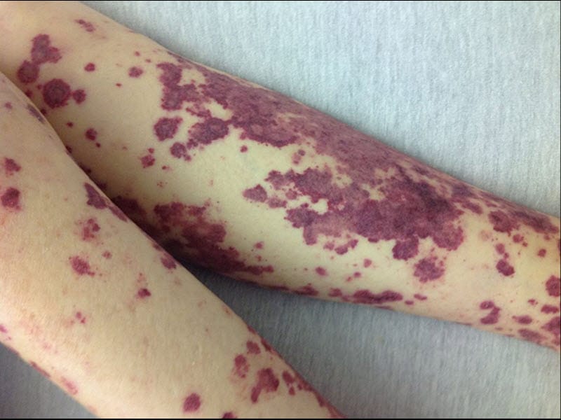 8 Causes of Altered Mental Status in the Elderly