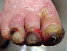 ss-common-foot-disorders