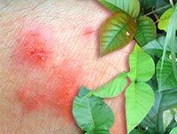 11 Common Plants That Can Cause Poisonings