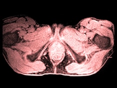 ss-defecation-disorders