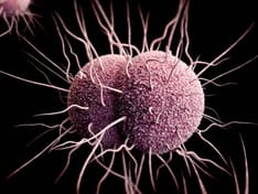 ss-multidrug-resistant-organisms