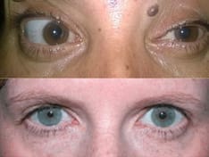 ss-neuro-ophthal-path