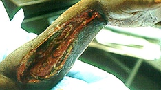 11 Opioid-Related Emergencies: When Highs May Become Fatal