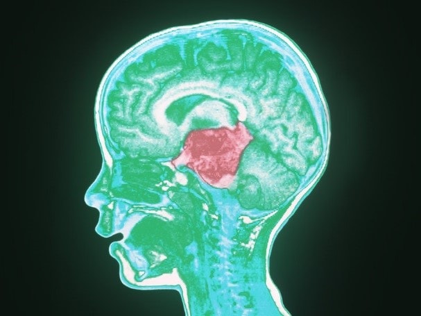 Neonatal and Infant Brain Imaging Evaluation