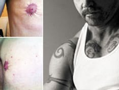 ss-transgender-patients