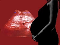 Don't Bump the Bump: Trauma in Pregnancy