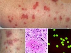 Leukocyte Count (WBC): Reference Range, Interpretation, Collection and ...