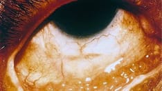 Visual Findings of 9 Sexually Transmitted Infections