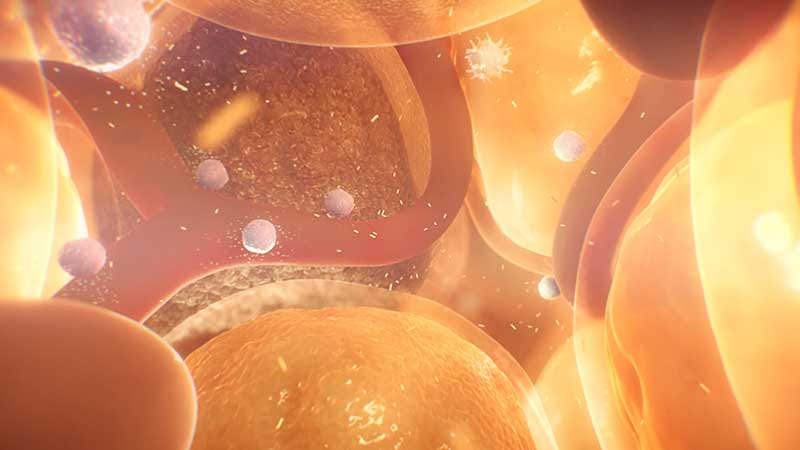 The Other Epidemic: Type 2 Diabetes and Obesity