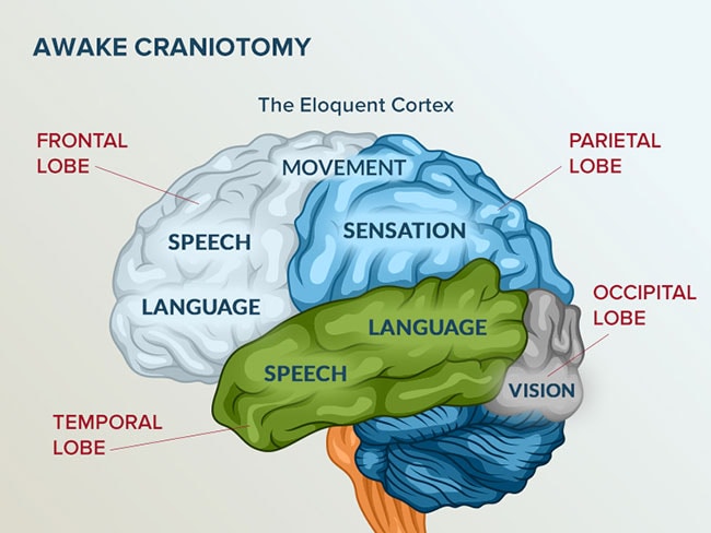 eloquent areas of the brain