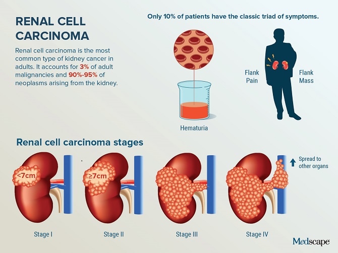 Trending Clinical Topics for February 2019