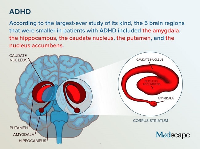 ADHD Brain Regions