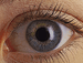 Corneal Tattooing Helps in the Management of Iris Defects