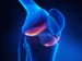 Evaluating Knee Pain: The Latest in Diagnosis and Management