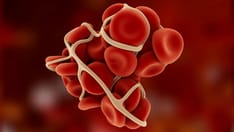 Study Suggests No Added Risk of Blood Clots in COVID-19 Outpatients
