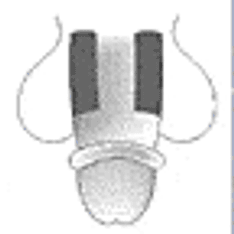Brethaire, Brethine (terbutaline) dosing, indications, interactions ...