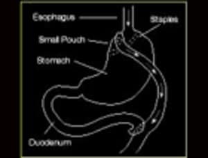 9 Causes of Discolored Urine