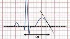 Common QTc Formula Can Led to Wrong Chemo Decisions