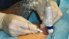 Falls in the Elderly: Causes, Injuries, and Management