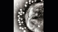 Can Phages Help Where Antibiotics Have Failed?