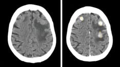 Contrast Shortage: Déjà vu All Over Again