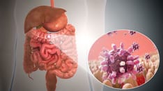 Acute Gastroenteritis in US CausesWidespread Disease