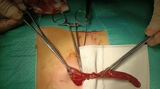 Can't-Miss Gastrointestinal Diagnoses