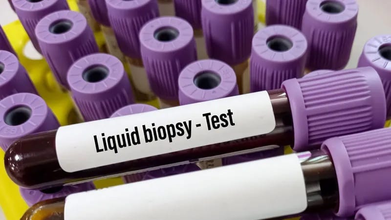 Mercy Bioanalytics and Delfi Diagnostics develop ovarian cancer tests
