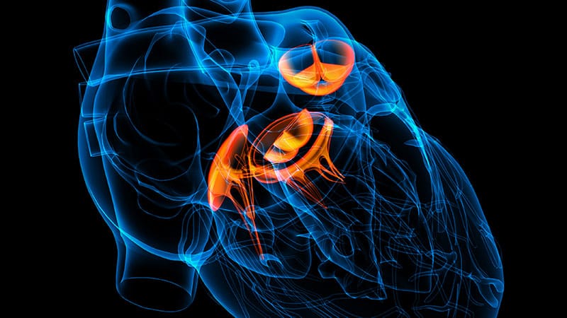 Tricuspid Repair Cuts Death, HF Hospitalization in Severe TR