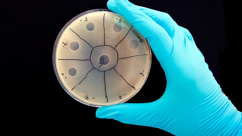 New Guidelines Set Phage Therapy as Specific Antibiotic Alternative