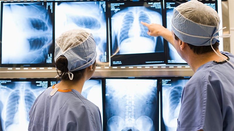AI Speeds Up Chest Radiograph Readings but Lowers Accuracy