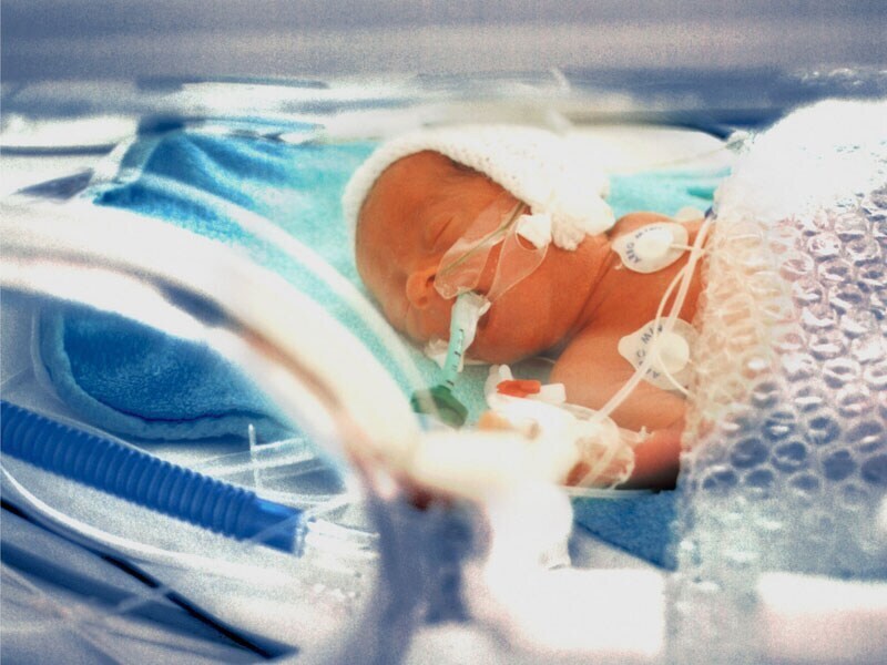 Do Premature Babies Have Higher Childhood Hospitalisation Rates than