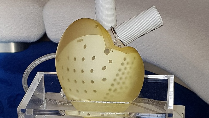 French Artificial-Heart Pioneer Carmat Faces Liquidation French Artificial-Heart Pioneer Carmat Faces Liquidation