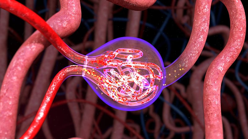 PPI Use Tied to Higher Risk for Low Blood Sodium Levels