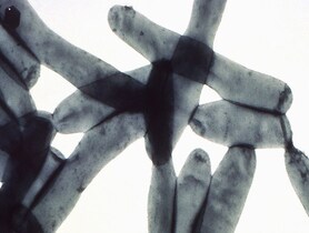 photo of Legionnaires disease
