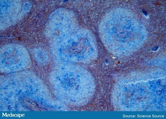 Hattr Fast Five Quiz: hATTR Treatment
